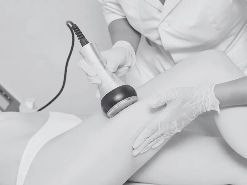 2 Rf_treatment_estheticaline